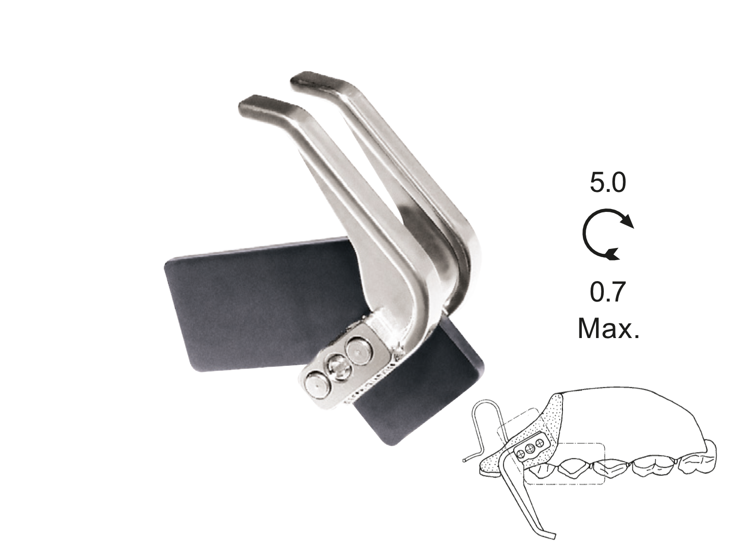 Memory Schraube Dehnschraube Oberkiefer