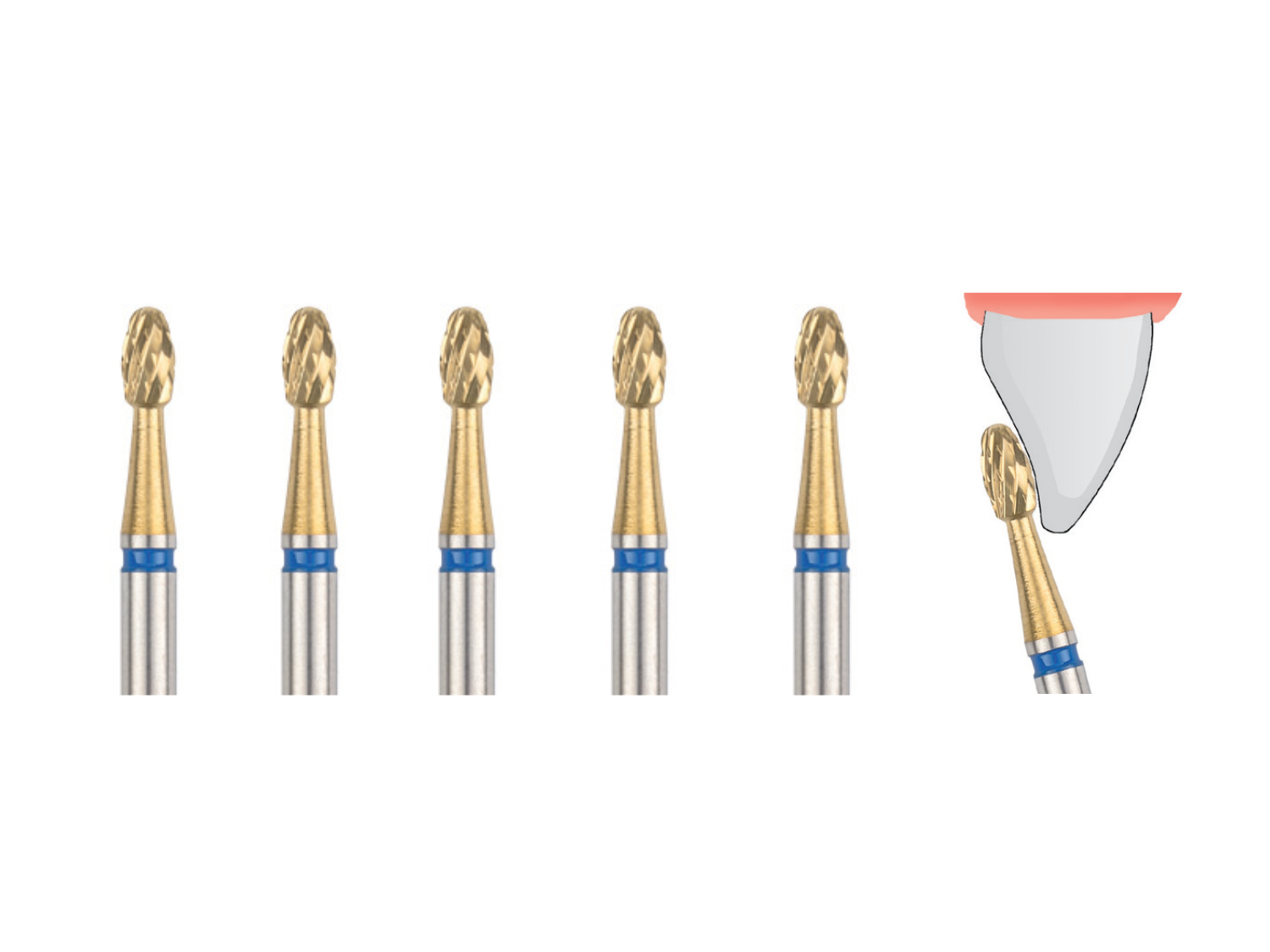 Titan-Nitrit Finierer groß .023 Klebstoffentferner für Winkelstück (5 Stück)